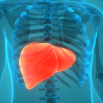 fatty-liver